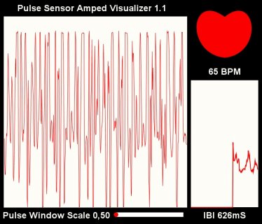 Pulse Sensor.jpg