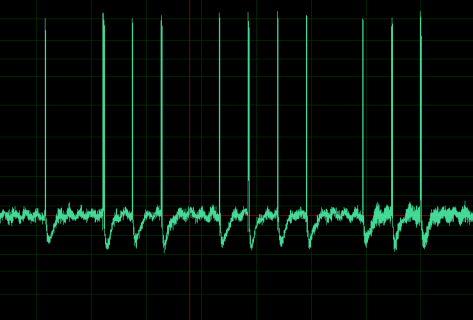 Capture2.PNG Capture2.PNG